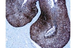 p16, JC2, Mouse, Monoclonal, ready to use 