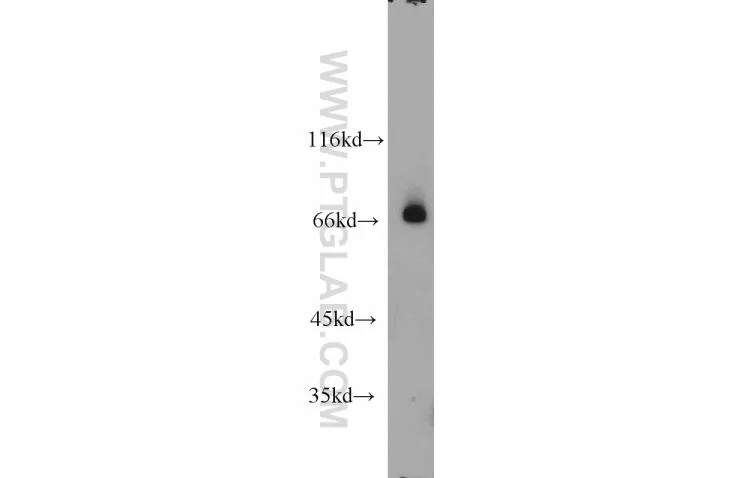RORA antibody (10616-1-AP)